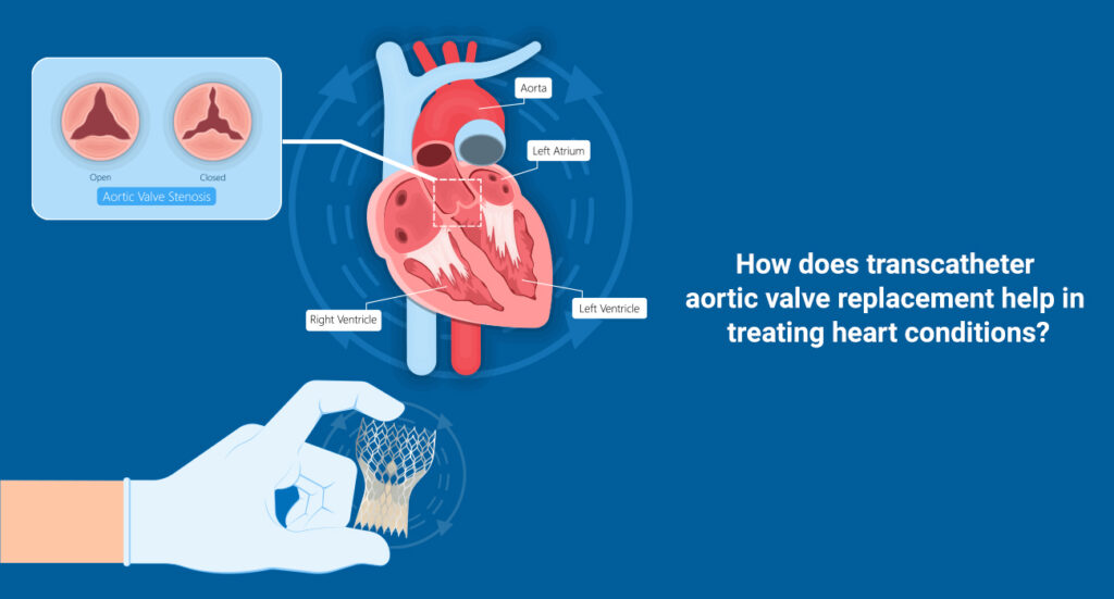 TAVR